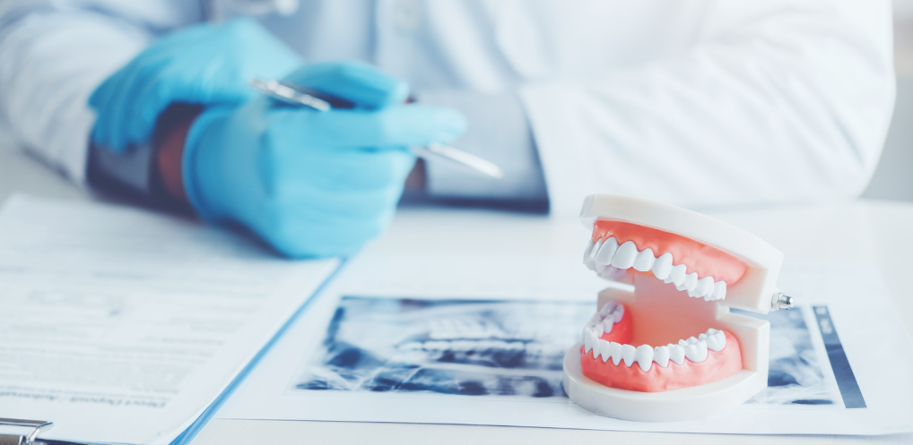 How to prevent tartar build-up