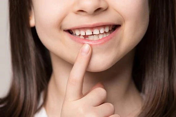 do you know the story of the tooth fairy?