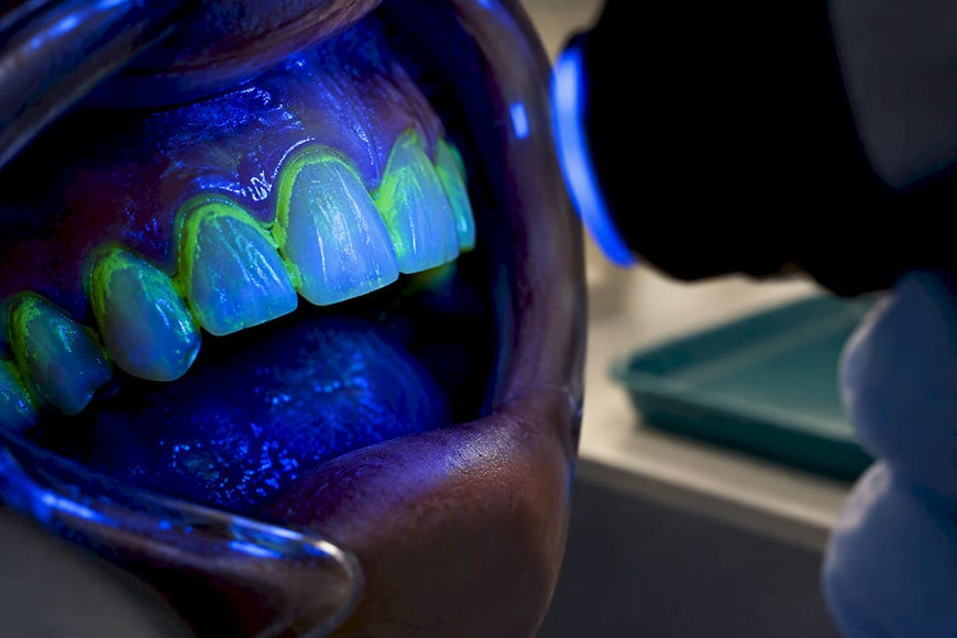Fluorescent plaque visible on tooth surfaces