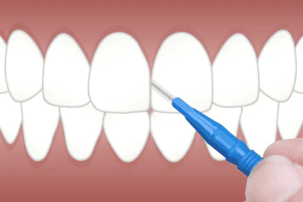 Why use an interdental brush ?