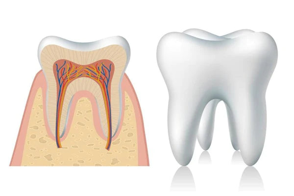 What is root decay ?